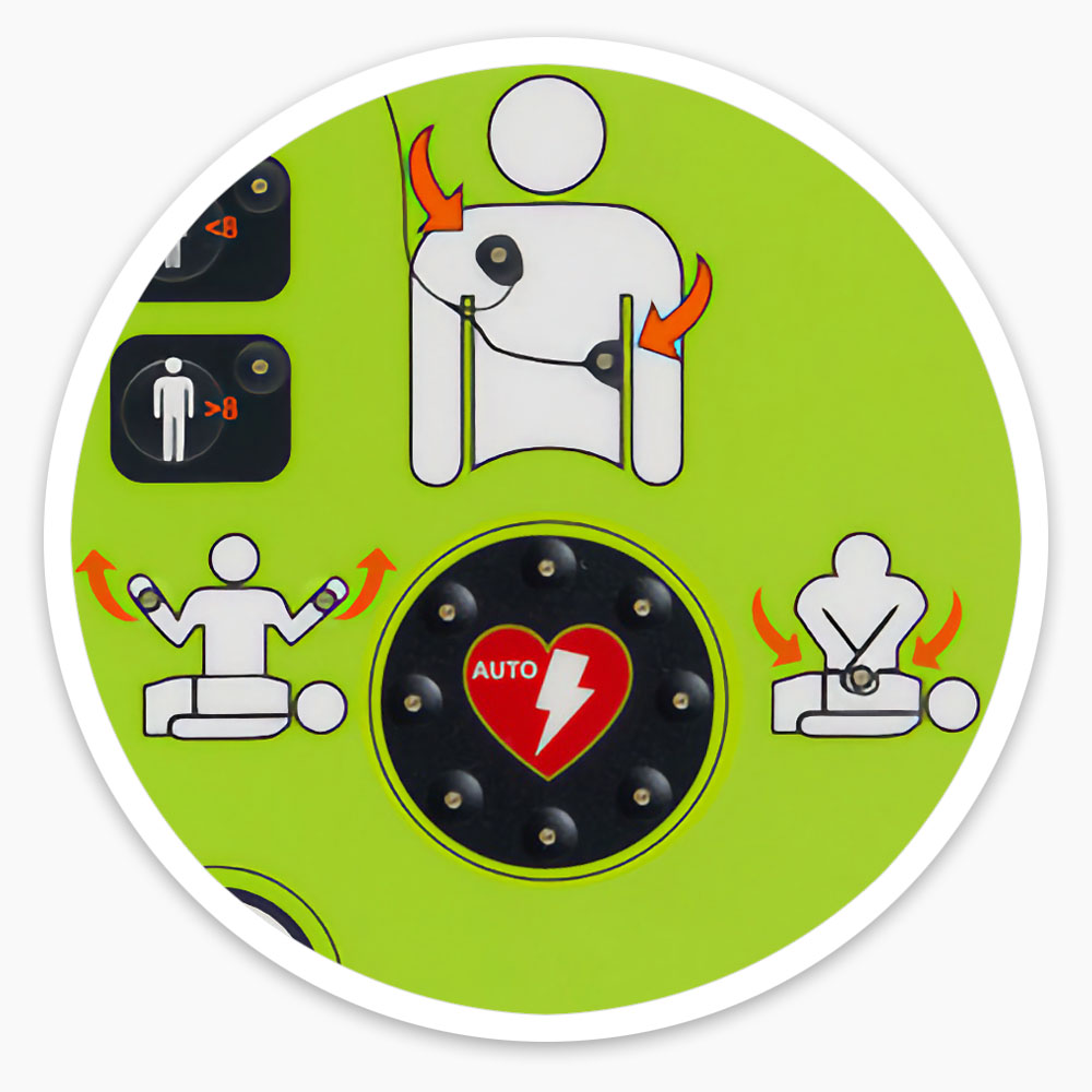 Fully-Automatic Defibrillator